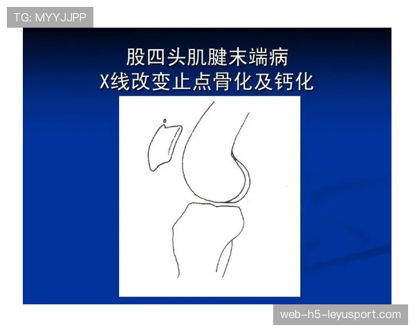 运动专项康复中基于肌电反馈的动作诱导装置
